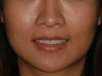 Konig Center for Cosmetic & Comprehensive Dentistry smile photos